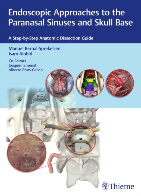 Endoscopic Approaches to the Paranasal Sinuses and Skull Base: A Step-by-Step Anatomic Dissection Guide
