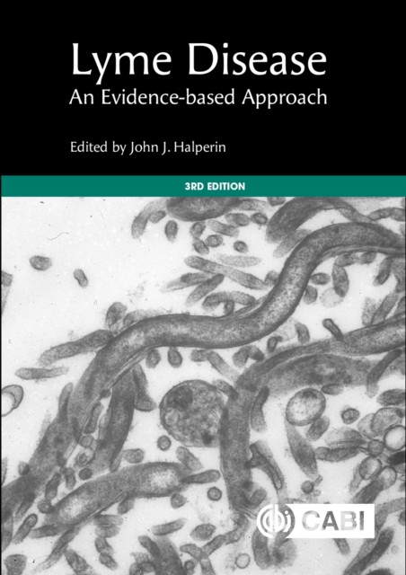 Lyme Disease: An Evidence-based Approach