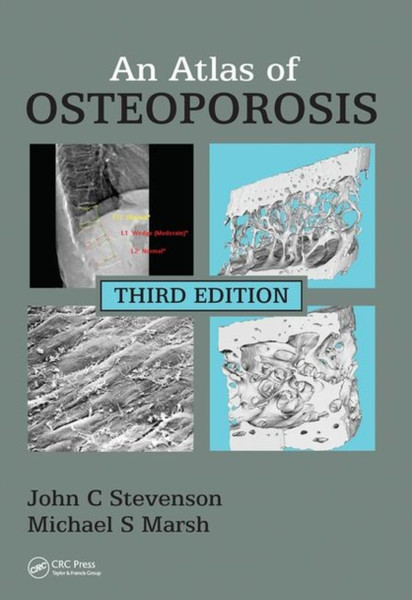 An Atlas Of Osteoporosis