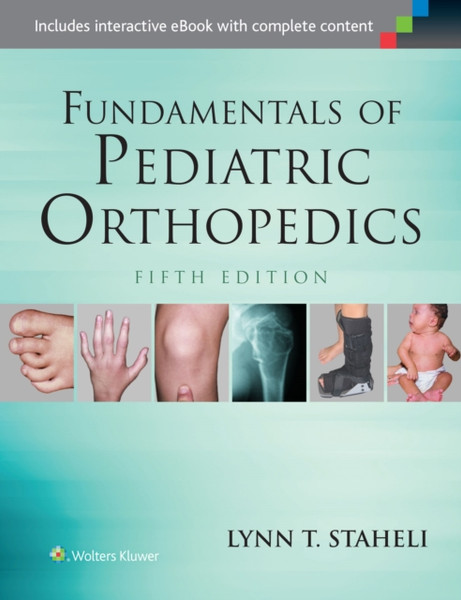 Fundamentals Of Pediatric Orthopedics