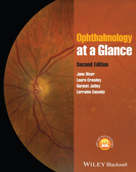 Ophthalmology at a Glance 2e