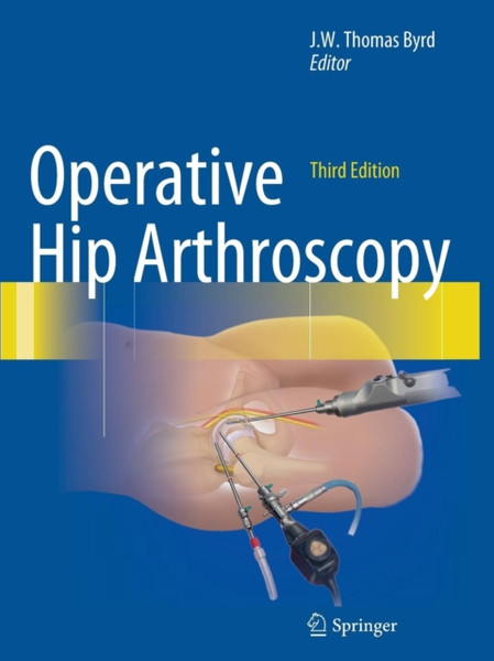 Operative Hip Arthroscopy