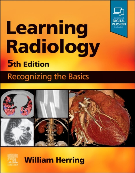 Learning Radiology : Recognizing the Basics