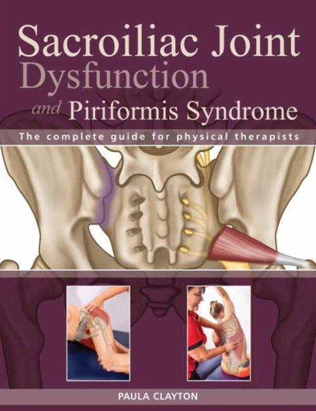 Sacroiliac Joint Dysfunction and Piriformis Syndrome : The Complete Guide for Physical Therapists