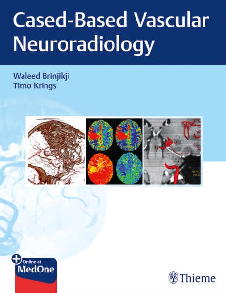 Imaging in Neurovascular Disease : A Case-Based Approach
