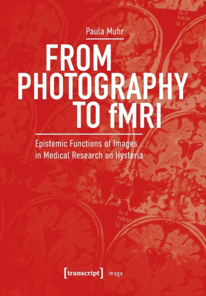 From Photography to fMRI : Epistemic Functions of Images in Medical Research on Hysteria