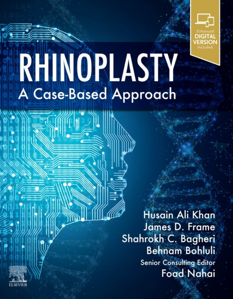 Rhinoplasty : a Case-based approach