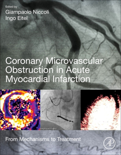 Coronary Microvascular Obstruction in Acute Myocardial Infarction : From Mechanisms to Treatment