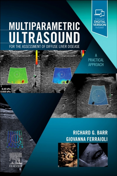 Multiparametric Ultrasound for the Assessment of Diffuse Liver Disease : A Practical Approach