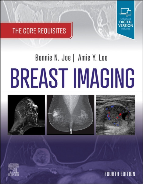 Breast Imaging : The Core Requisites