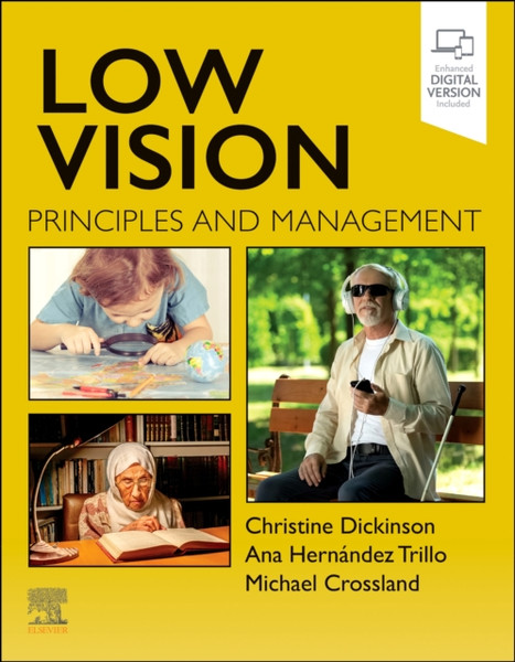 Low Vision : Principles and Management