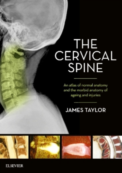 The Cervical Spine : An atlas of normal anatomy and the morbid anatomy of ageing and injuries