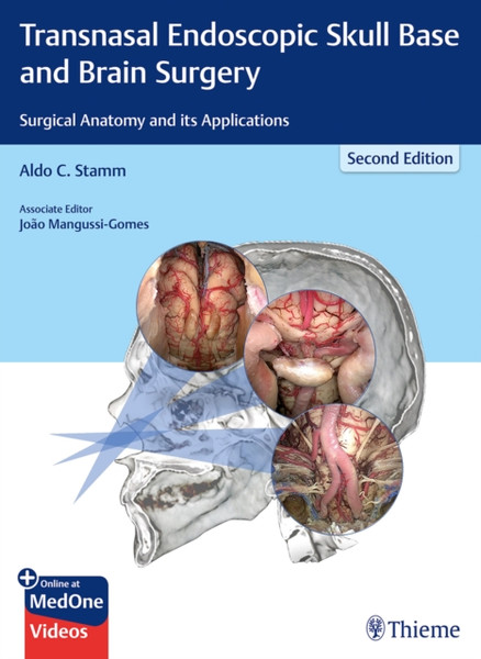 Transnasal Endoscopic Skull Base and Brain Surgery : Surgical Anatomy and its Applications