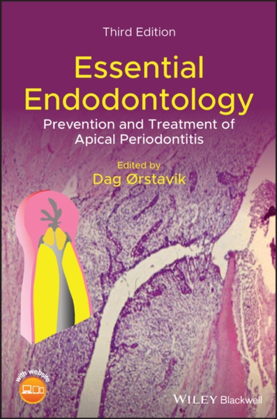 Essential Endodontology - Prevention and Treatment of Apical Periodontitis, 3rd Edition