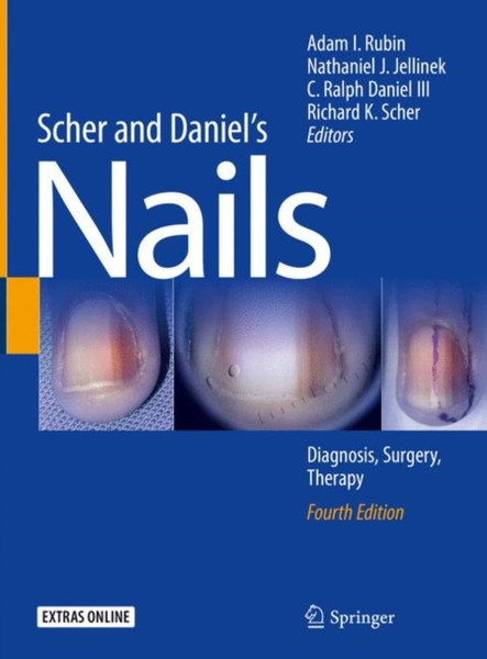 Scher and Daniel's Nails : Diagnosis, Surgery, Therapy