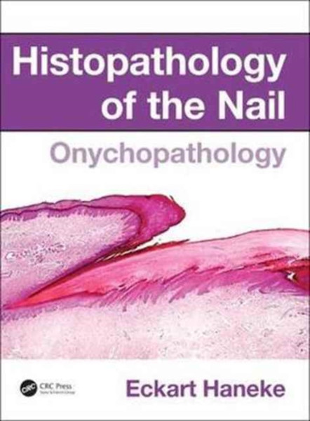 Histopathology of the Nail : Onychopathology