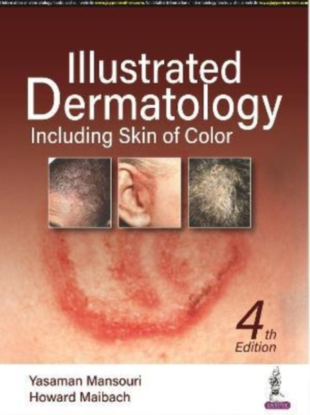 Illustrated Dermatology : Including Skin of Colour