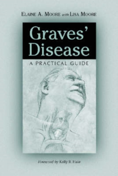 Graves' Disease : A Practical Guide