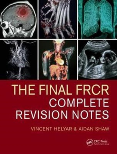 The Final FRCR : Complete Revision Notes