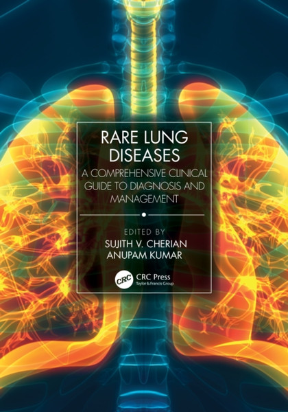 Rare Lung Diseases : A Comprehensive Clinical Guide to Diagnosis and Management