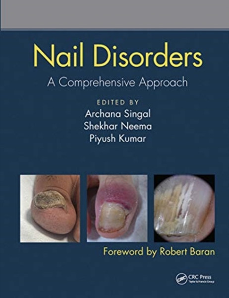 Nail Disorders : A Comprehensive Approach