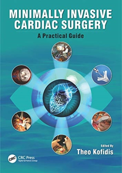 Minimally Invasive Cardiac Surgery : A Practical Guide