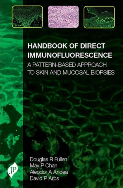 Handbook of Direct Immunofluorescence : A Pattern-Based Approach to Skin and Mucosal Biopsies