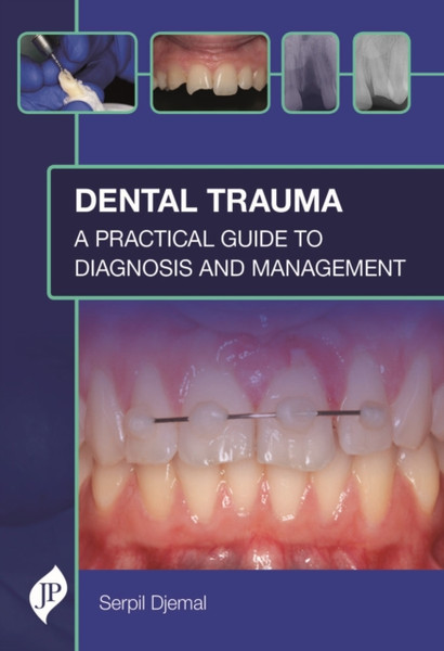 Dental Trauma : A Practical Guide to Diagnosis and Management