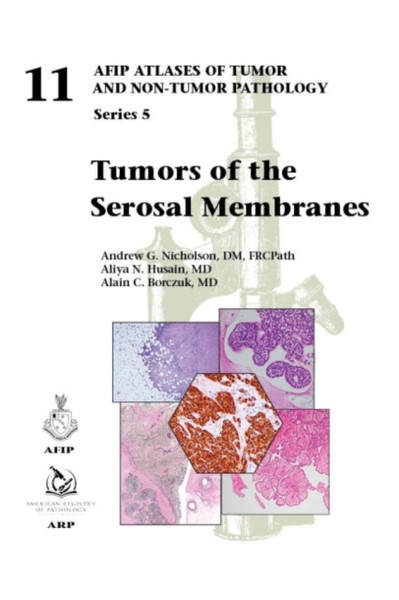 Tumors of the Serosal Membranes