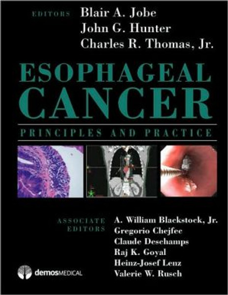 Esophageal Cancer by Blair Jobe (Author)