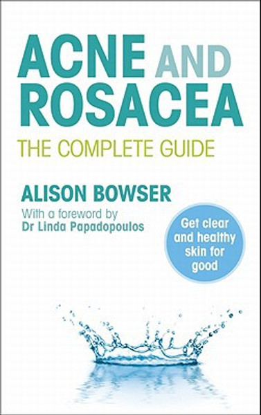 Acne and Rosacea: The Complete Guide