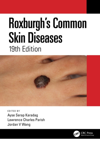 Roxburgh'S Common Skin Diseases