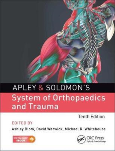 Apley & Solomon'S System Of Orthopaedics And Trauma