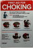 FIRST AID FOR CHOKING - Resturant chocking