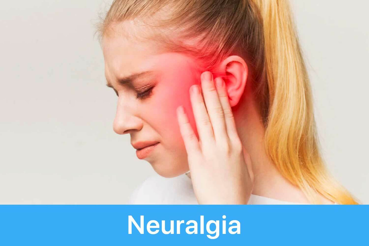 Neuralgia