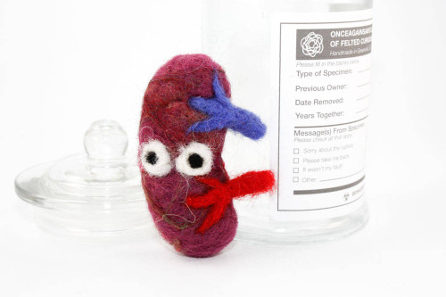 Felted Spleen in Specimen Jar (Quirky Get Well Gift)