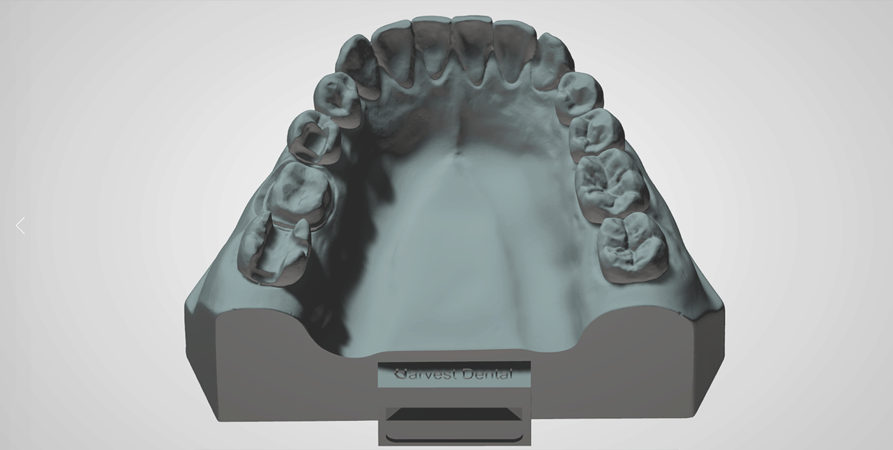 Vertex Disposable Articulator
