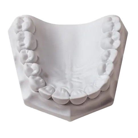 Whip Mix MOUNTING PLASTER 100/100G