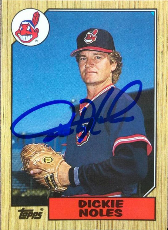 Dickie Noles Autographed 1987 Topps Tiffany #244