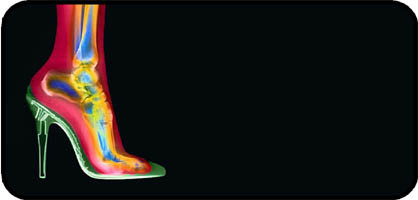 Heel X Ray