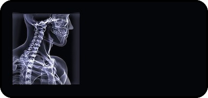 X Ray Man