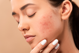 Sensitive Skin: How Less is More When It Comes to Beauty Products