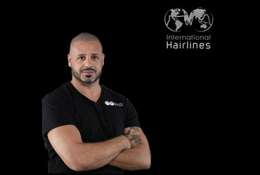 Seif Sidky Teams Up With Quantum PMU: Redefining Scalp Micropigmentation Excellence