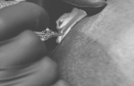 Scalp Micro Pigments