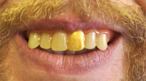 Teeth Glow Gold Miner Adult