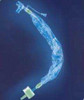 Closed Suction Catheter Trach Care® 10 Fr. 2103 Pack of 1