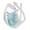 McKesson Anesthesia Breathing Circuit Expandable Tube 96 Inch Tube Dual Limb Adult 3 Liter Bag Single Patient Use 16-D96M3 Pack of 1