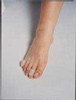 Corn Protector PediFix® Small / Medium Pull-On Toe 1000 Pack of 1