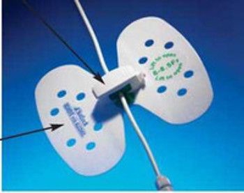 Drainage Catheter Stabilization Device Statlock Universal Plus VUPD1416 Box of 25