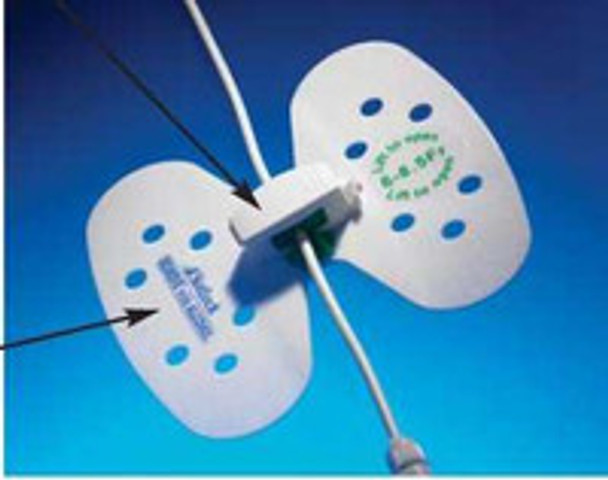 Universal Plus Stabilization Device Statlock VUPD68 Pack of 1